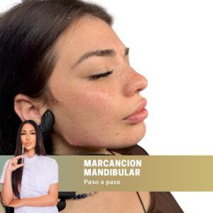 Curso Online: Relleno Facial